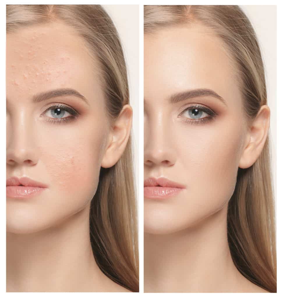 Clary Esthetician Facial Treatment Results